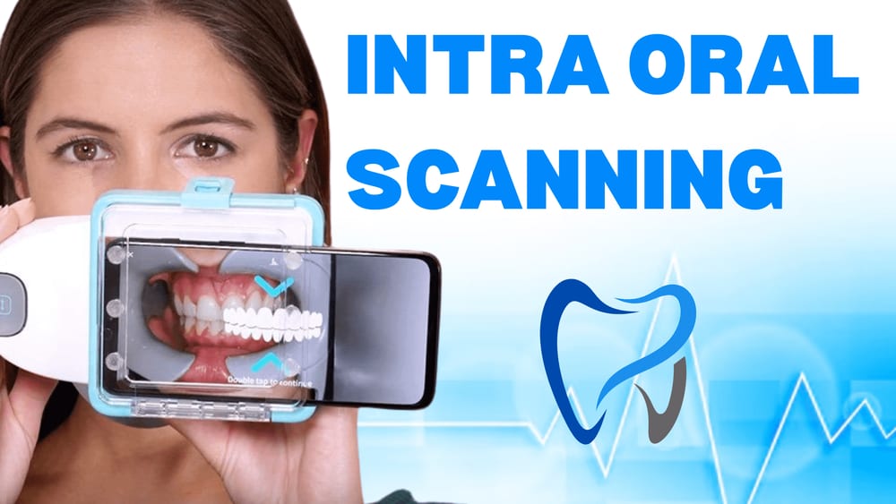 Intra Oral Scanning in Jaipur at Manglam Dental Hospital